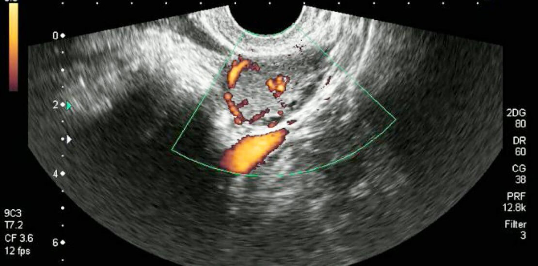 Енциклопедія захворювань
