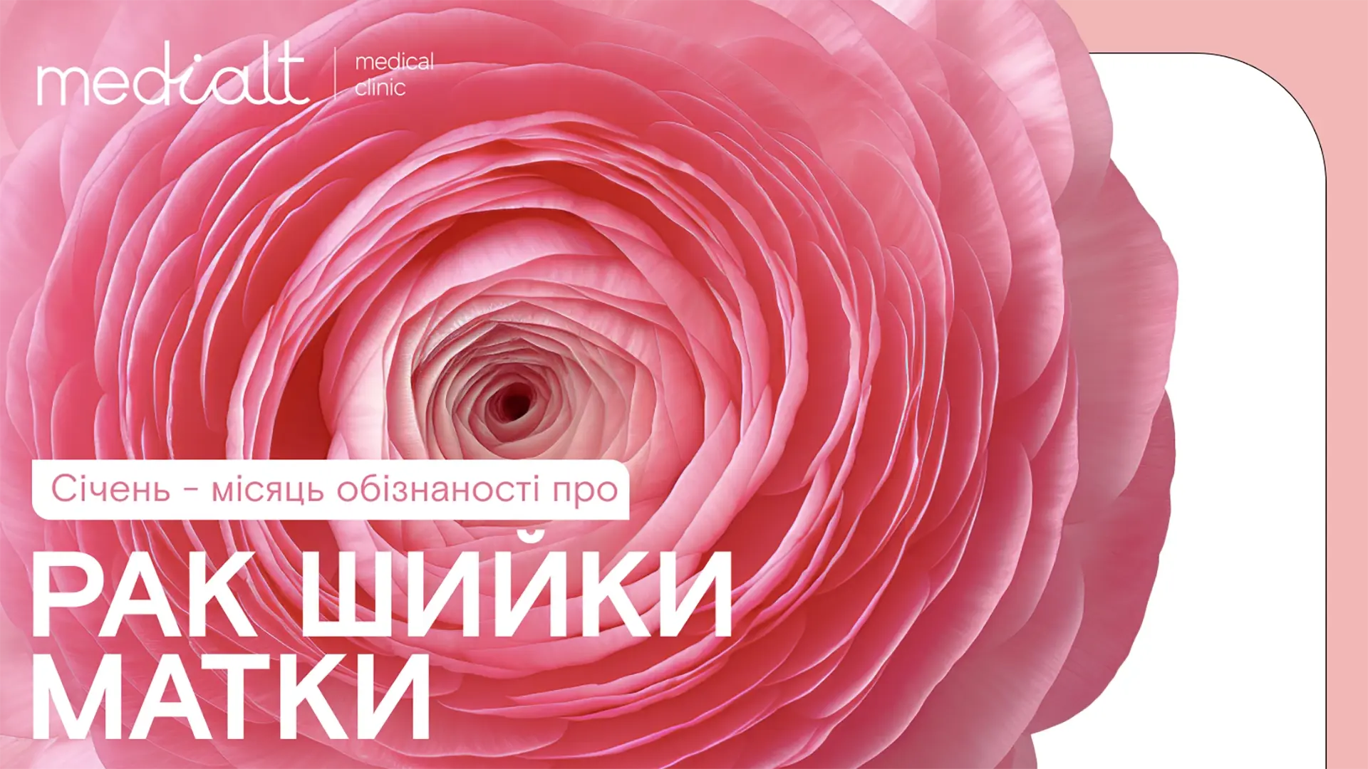 Рак молочних залоз